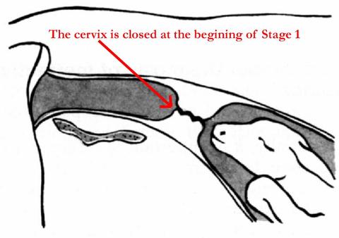 Cervix diagram