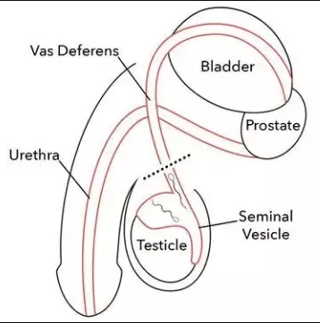 vasectomia del toro